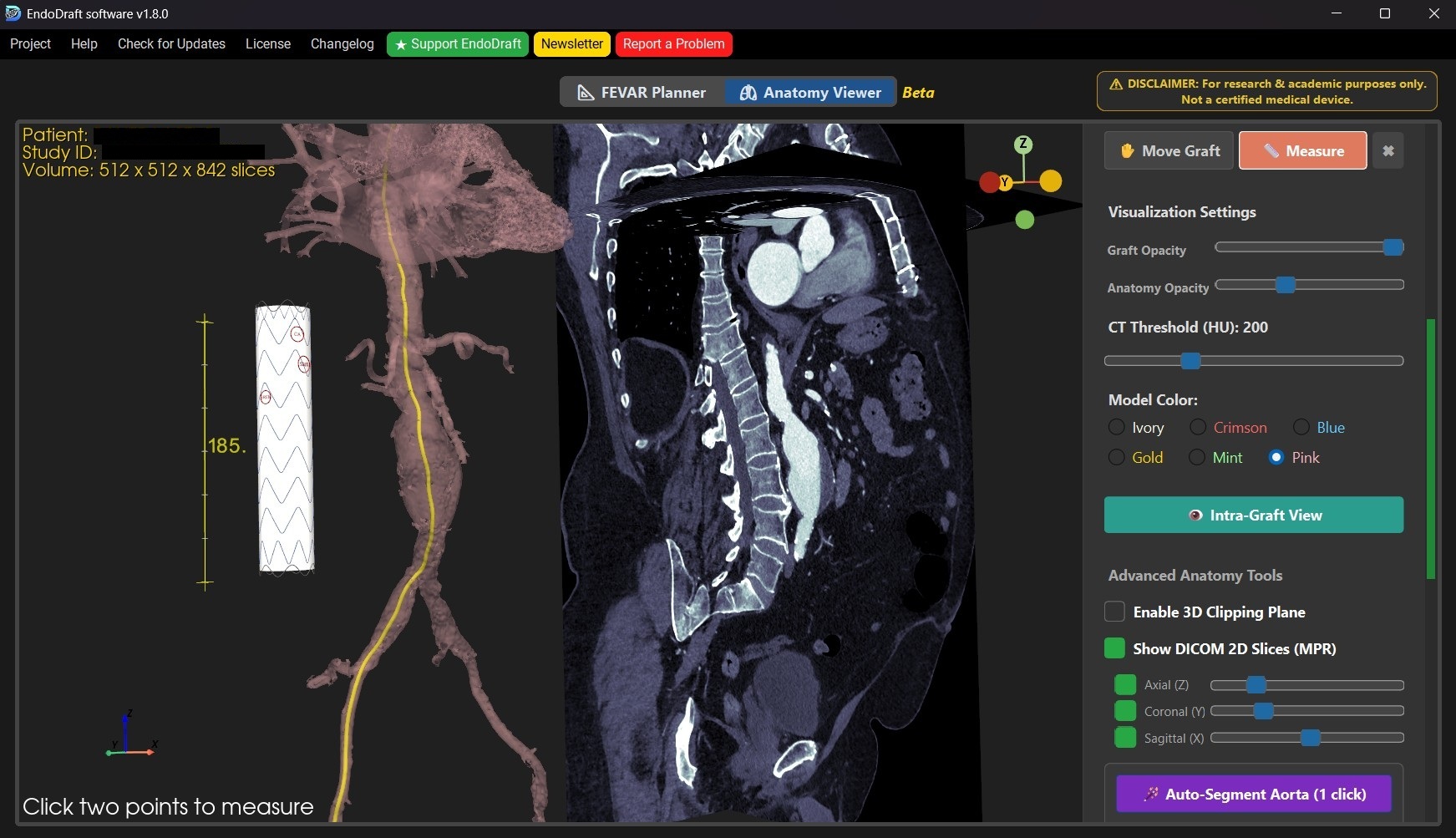 Aortic Segmentation
